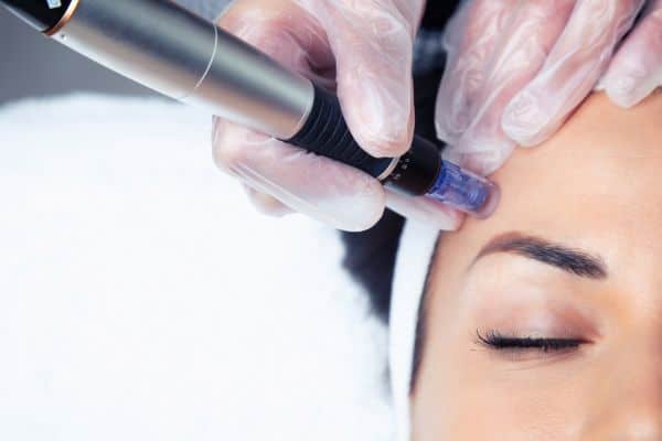 Explaining Total Skin Tightening Treatment and What to Expect 2 What Skin Concerns Can Total Skin Tightening Treatment Help With Bexhill?