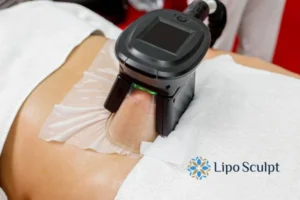 Does Fat Freezing At Home Work? 3 Fat freezing at home from Lipo Sculpt Bexhill